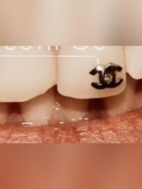 CC 18kt Gold Logo Tooth Jewel
